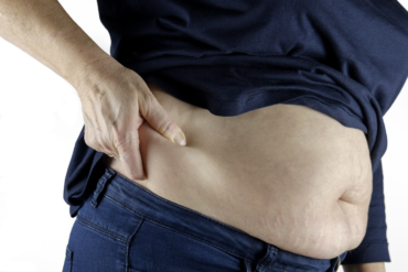 Verbluffende resultaten met transformational cupping voor de buik!